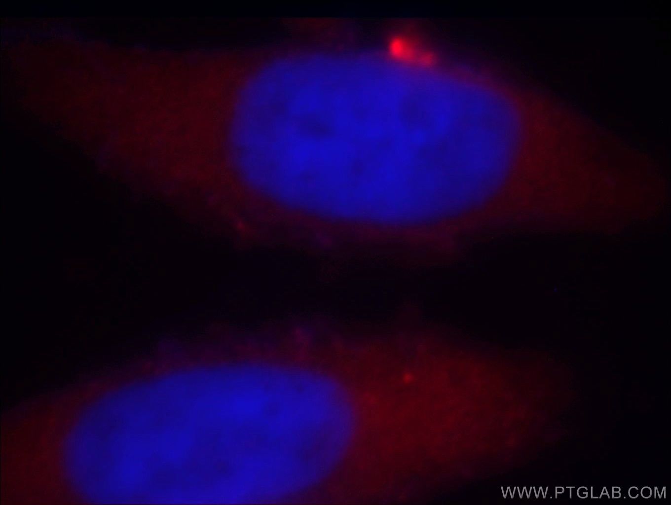 Immunofluorescence (IF) / fluorescent staining of MCF-7 cells using TARS Polyclonal antibody (14773-1-AP)