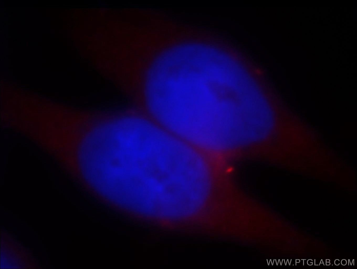 IF Staining of HeLa using 14773-1-AP