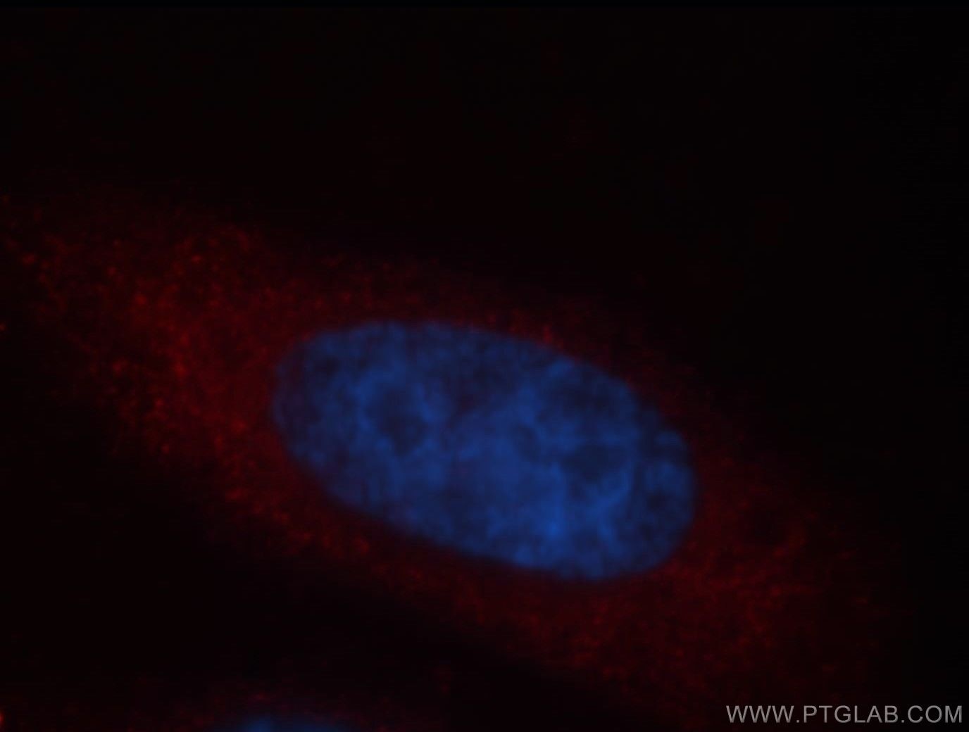 Immunofluorescence (IF) / fluorescent staining of HepG2 cells using TARS Polyclonal antibody (14773-1-AP)