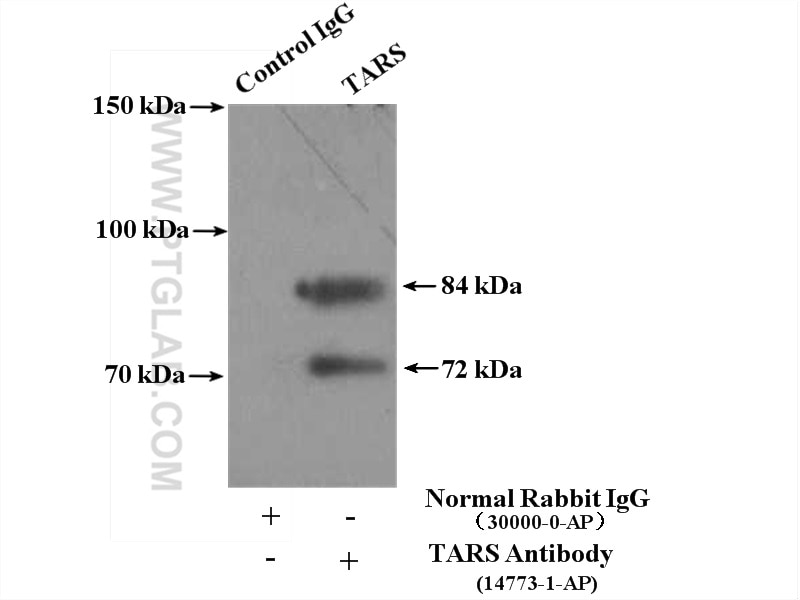 Immunoprecipitation (IP) experiment of A549 cells using TARS Polyclonal antibody (14773-1-AP)