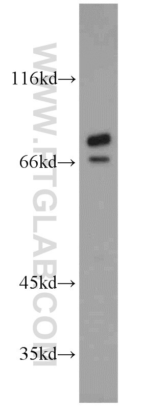 Western Blot (WB) analysis of A549 cells using TARS Polyclonal antibody (14773-1-AP)