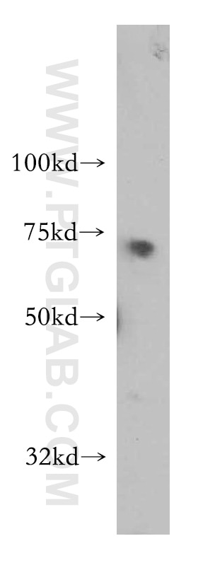 Western Blot (WB) analysis of A549 cells using TARS Polyclonal antibody (14773-1-AP)