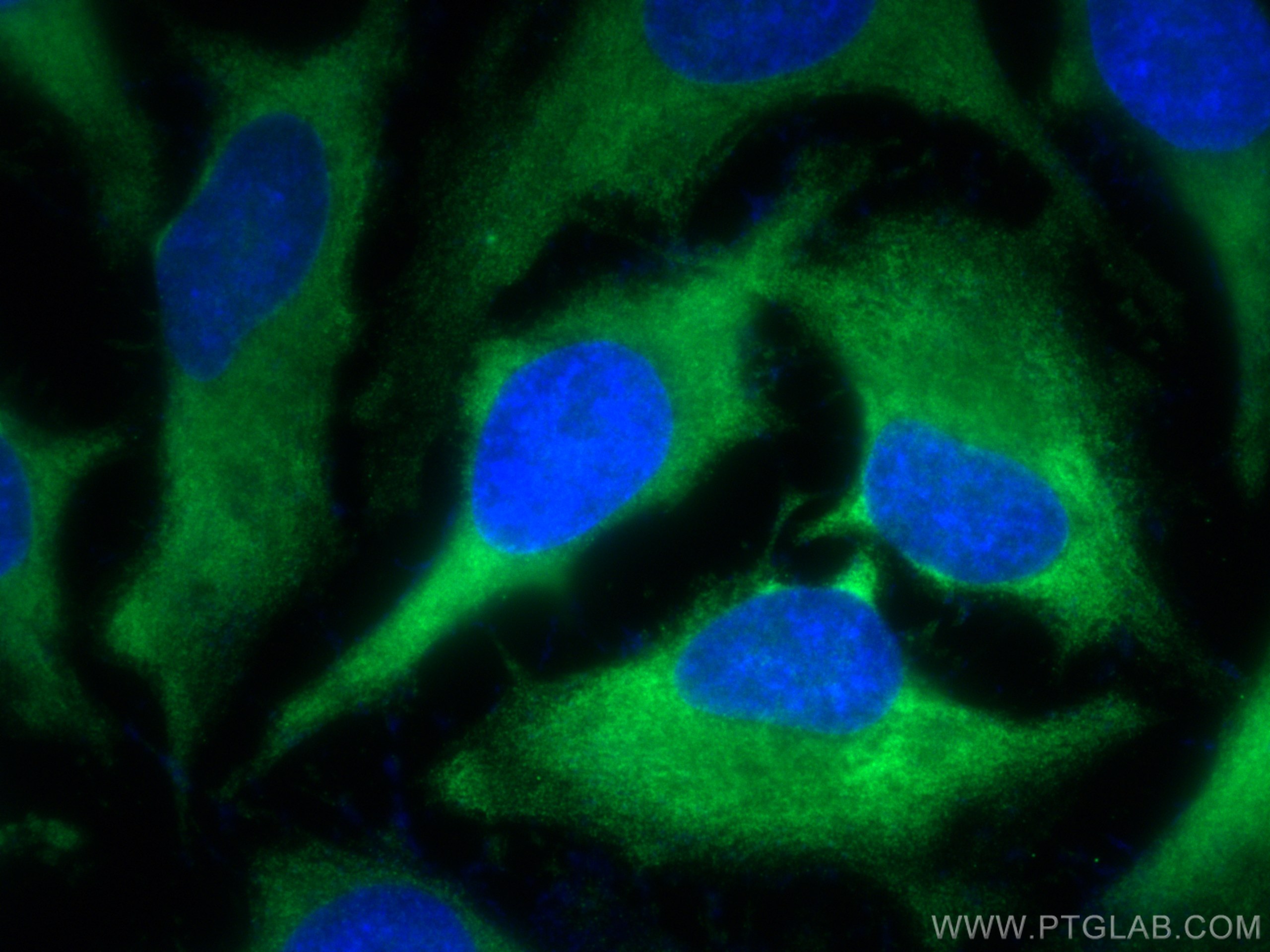 Immunofluorescence (IF) / fluorescent staining of HeLa cells using TARS Monoclonal antibody (67828-1-Ig)