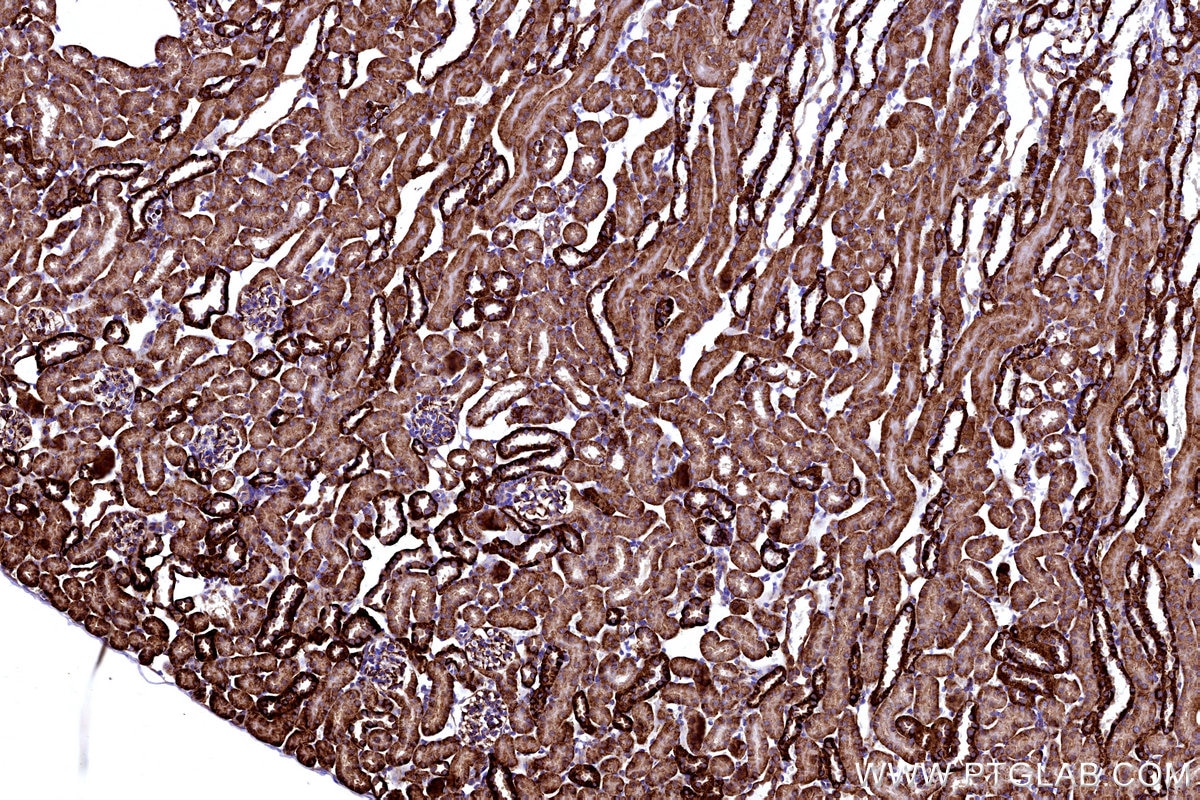 IHC staining of mouse kidney using 67828-1-Ig Immunohistochemistry (IHC) staining of mouse kidney tissue using TARS Monoclonal antibody (67828-1-Ig)