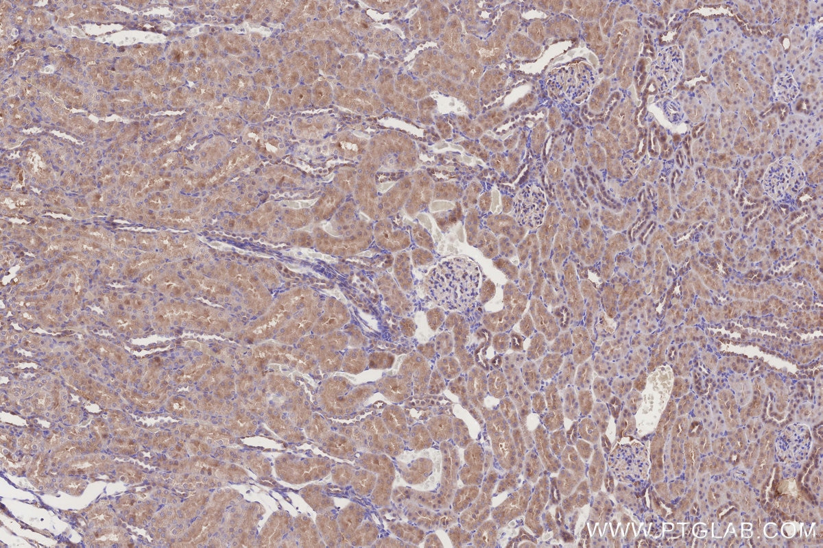 IHC staining of rat kidney using 67828-1-Ig Immunohistochemistry (IHC) staining of rat kidney tissue using TARS Monoclonal antibody (67828-1-Ig)