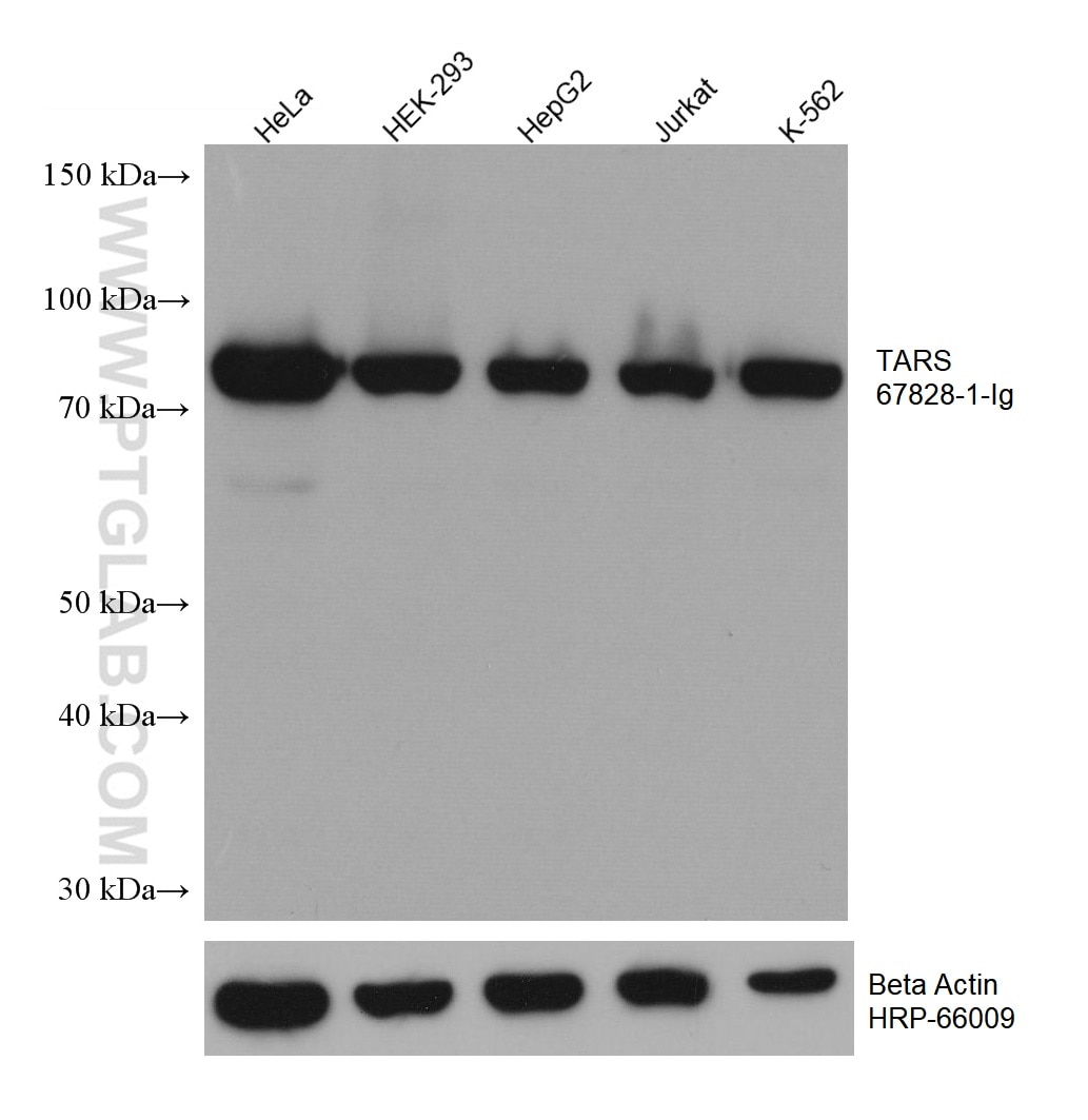 Western Blot (WB) analysis of various lysates using TARS Monoclonal antibody (67828-1-Ig)
