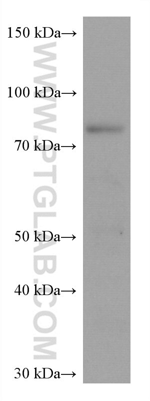 WB analysis of PC-12 using 67828-1-Ig