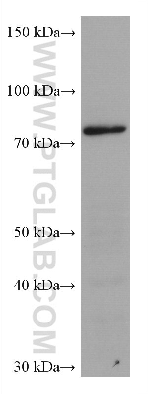 Western Blot (WB) analysis of 4T1 cells using TARS Monoclonal antibody (67828-1-Ig)
