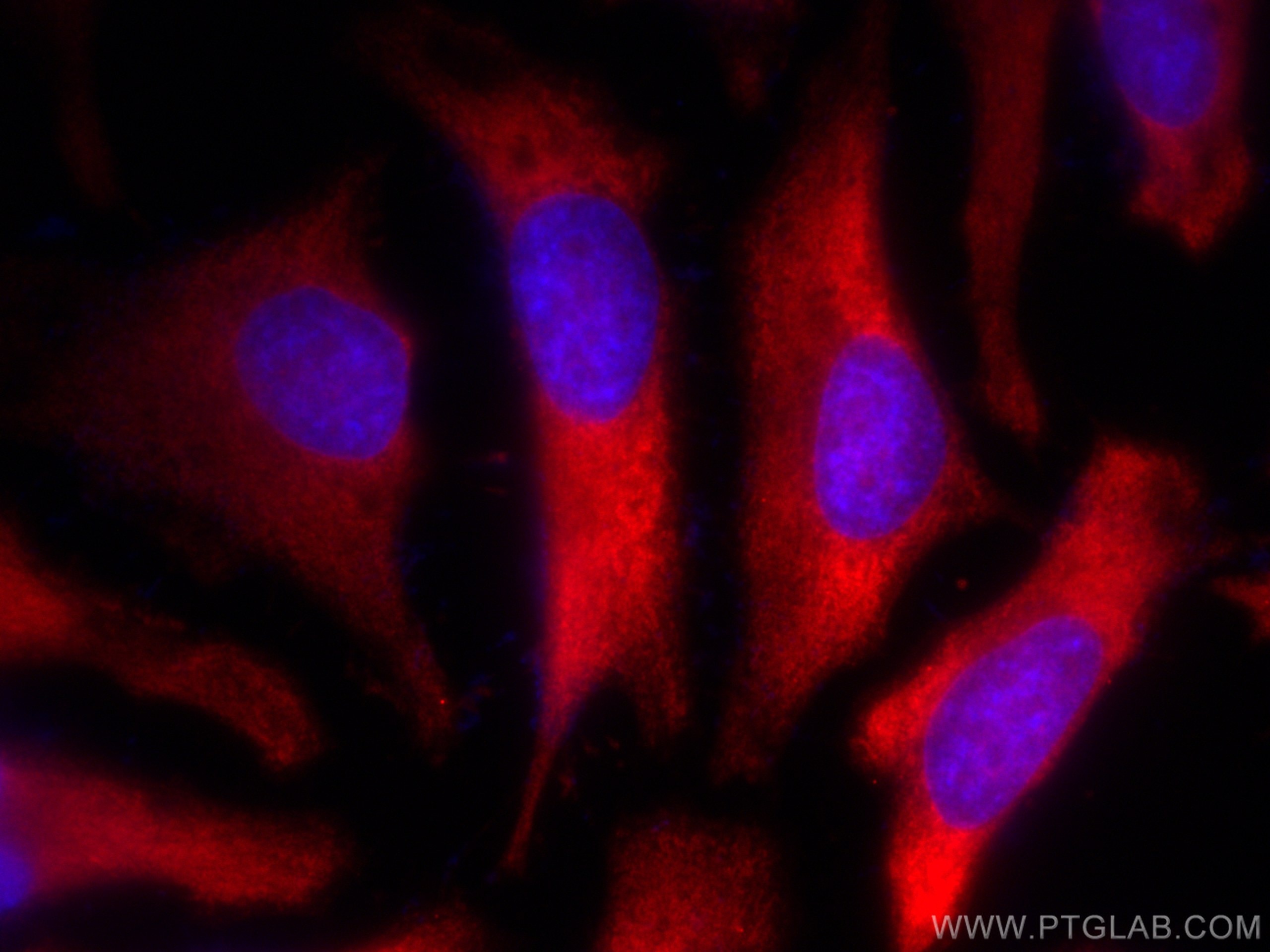 Immunofluorescence (IF) / fluorescent staining of HeLa cells using CoraLite®594-conjugated TARS Monoclonal antibody (CL594-67828)