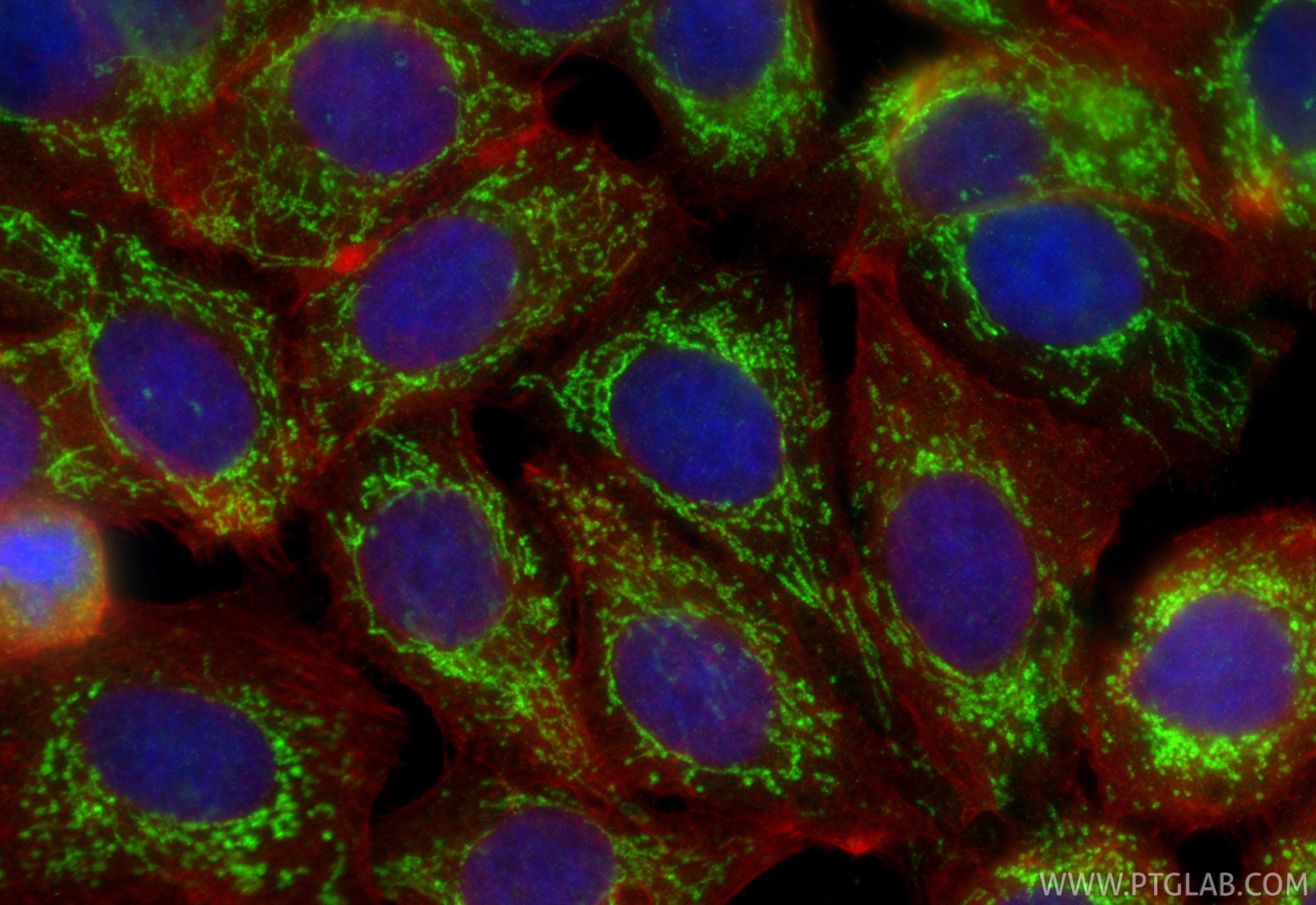 Immunofluorescence (IF) / fluorescent staining of MCF-7 cells using TARS2 Polyclonal antibody (15067-1-AP)