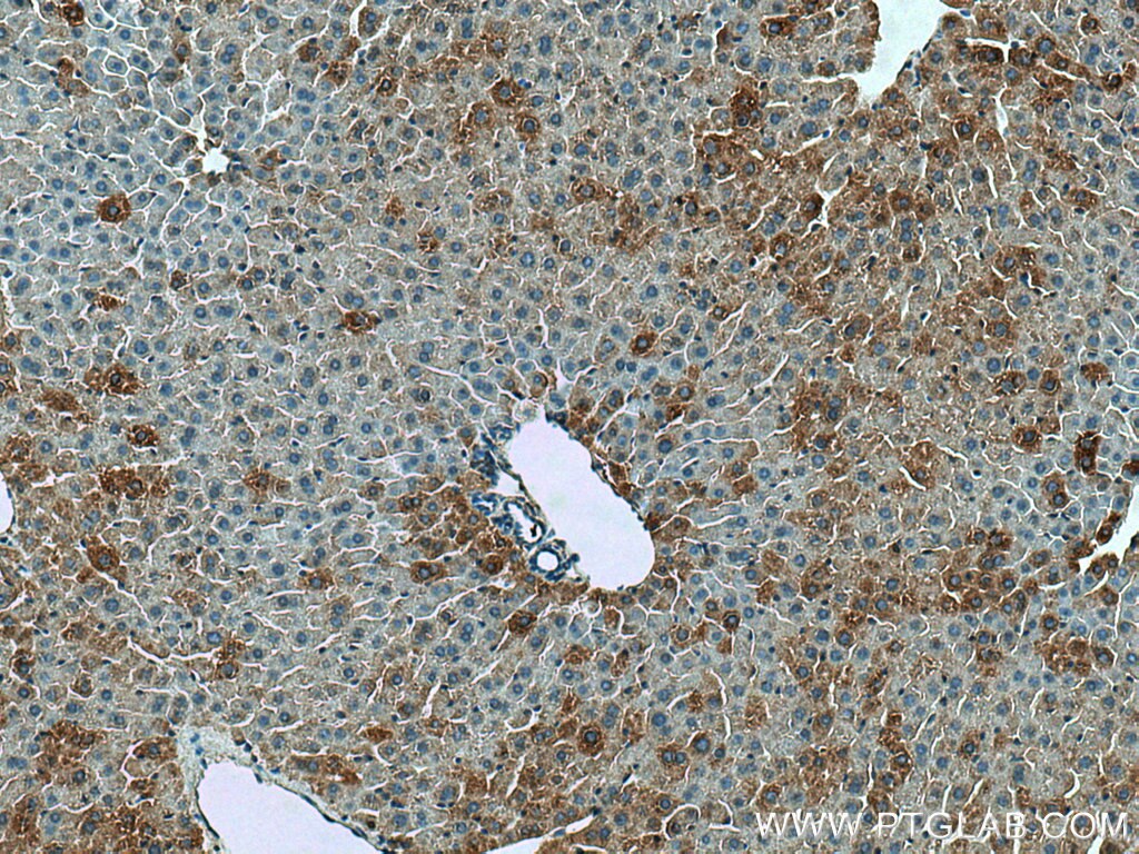 Immunohistochemistry (IHC) staining of mouse liver tissue using TARS2 Polyclonal antibody (15067-1-AP)