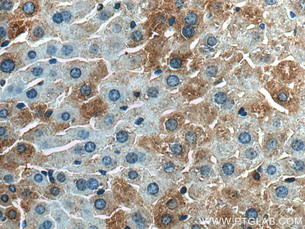 Immunohistochemistry (IHC) staining of mouse liver tissue using TARS2 Polyclonal antibody (15067-1-AP)