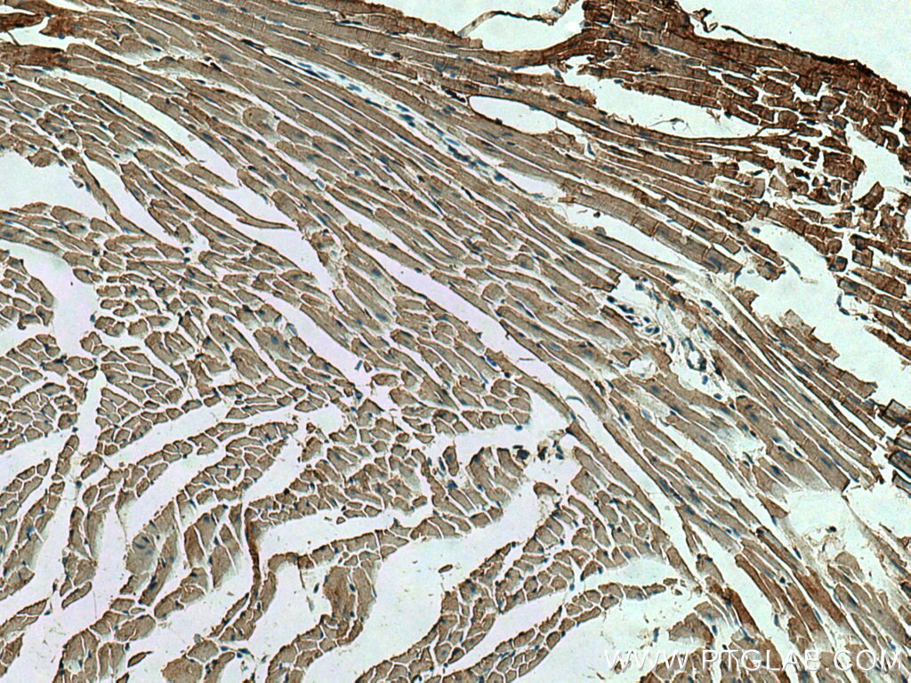 Immunohistochemistry (IHC) staining of mouse heart tissue using TARS2 Polyclonal antibody (15067-1-AP)