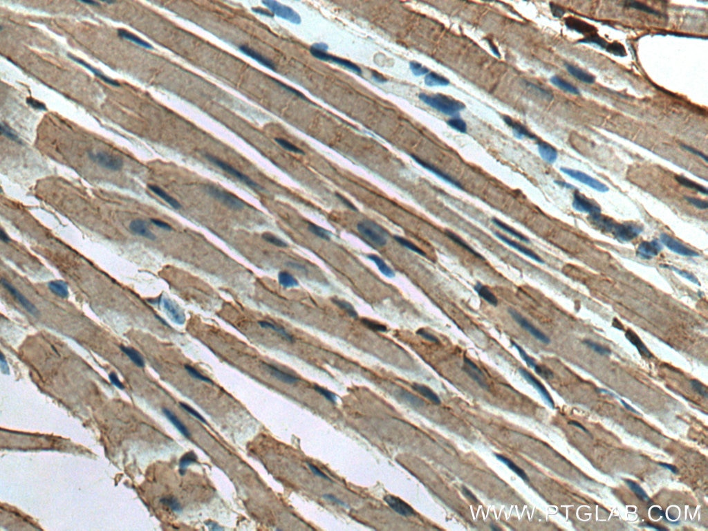 Immunohistochemistry (IHC) staining of mouse heart tissue using TARS2 Polyclonal antibody (15067-1-AP)