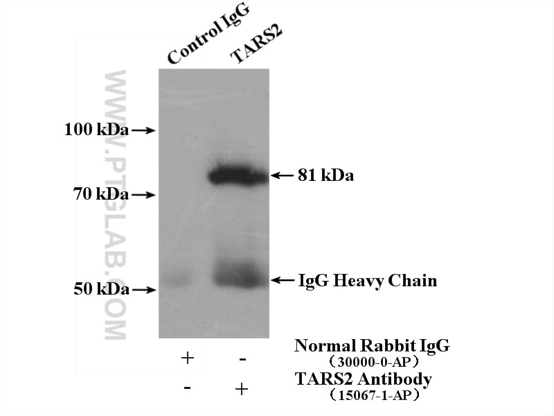 Immunoprecipitation (IP) experiment of mouse liver tissue using TARS2 Polyclonal antibody (15067-1-AP)