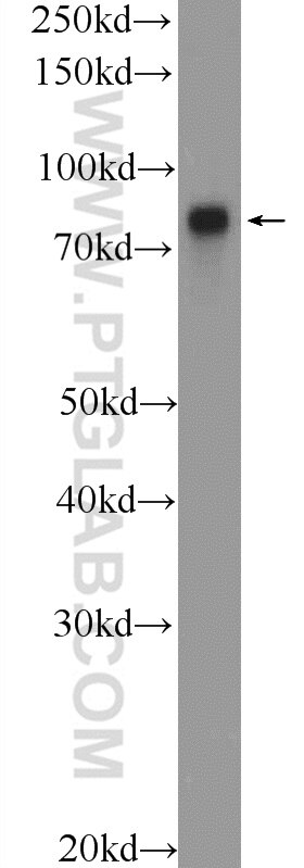 WB analysis of HeLa using 15067-1-AP