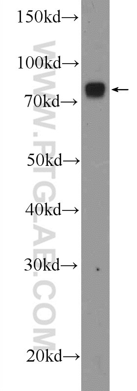 WB analysis of mouse liver using 15067-1-AP