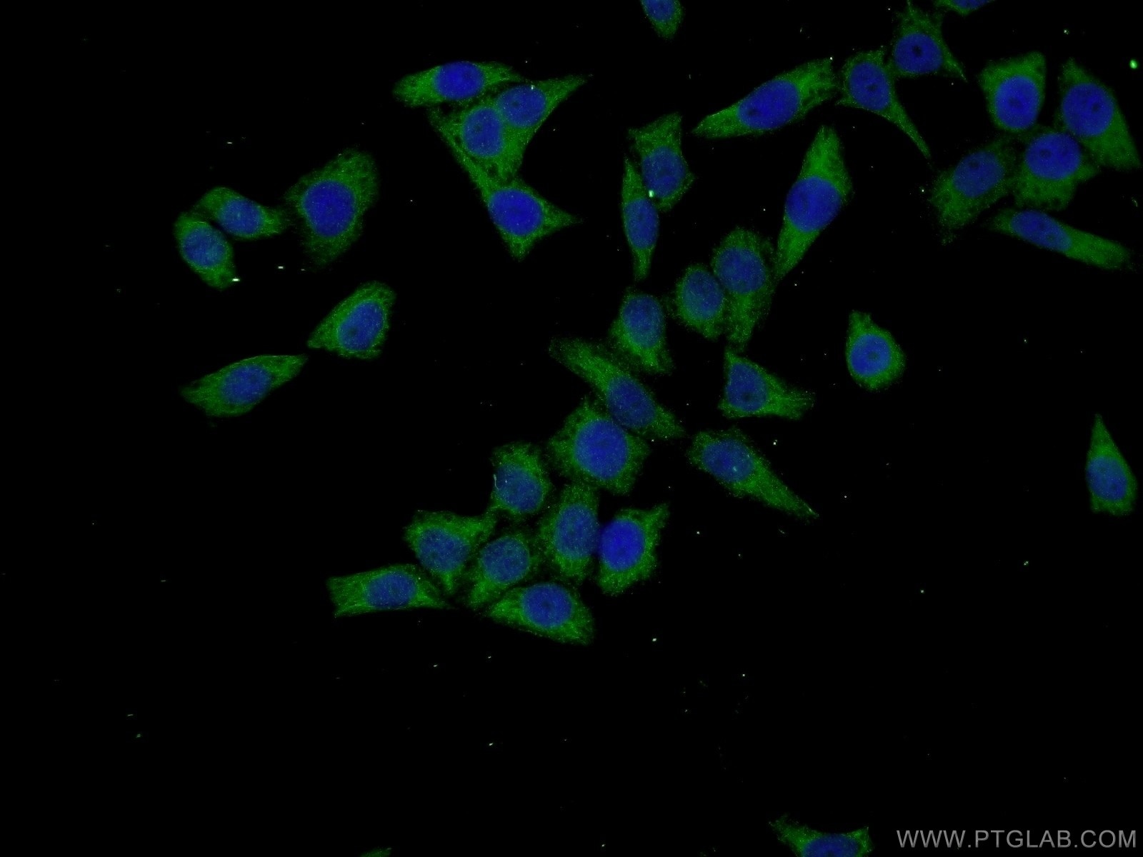 Immunofluorescence (IF) / fluorescent staining of L02 cells using TARSL2 Polyclonal antibody (24635-1-AP)