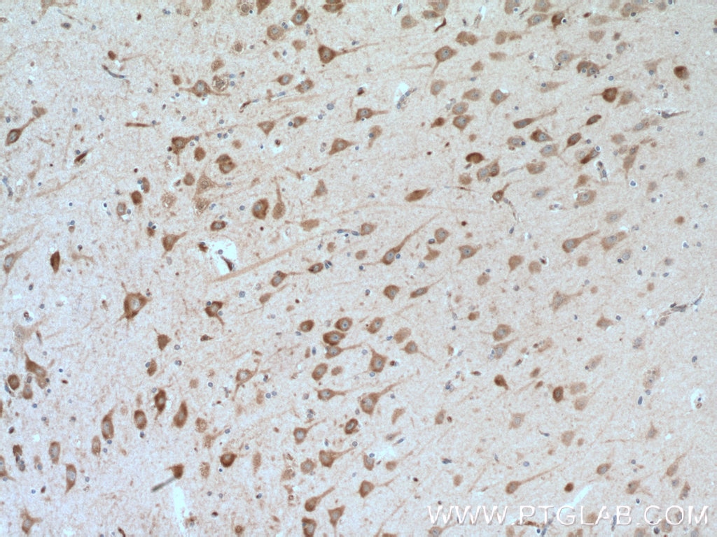 Immunohistochemistry (IHC) staining of human brain tissue using TARSL2 Polyclonal antibody (24635-1-AP)