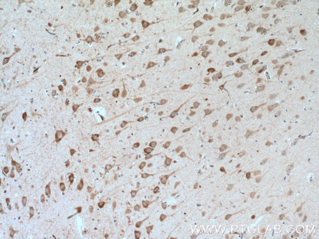 IHC staining of human brain using 24635-1-AP