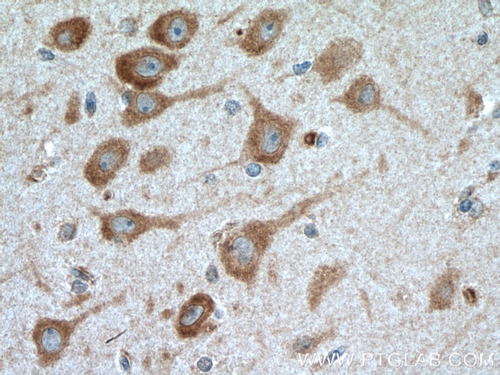 Immunohistochemistry (IHC) staining of human brain tissue using TARSL2 Polyclonal antibody (24635-1-AP)