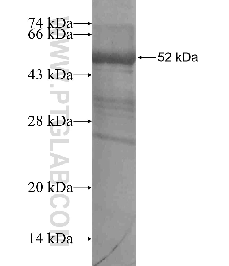 TARSL2 fusion protein Ag18298 SDS-PAGE