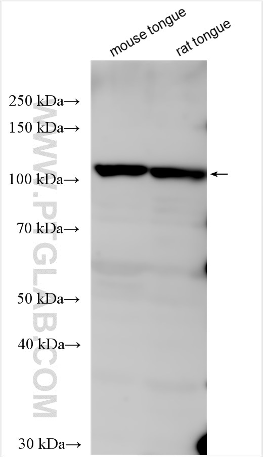 Western Blot (WB) analysis of various lysates using TAS1R2 Polyclonal antibody (29344-1-AP)