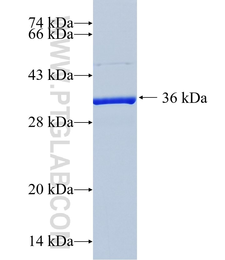 TAS2R10 fusion protein Ag36148 SDS-PAGE TAS2R10 fusion protein Ag36148 SDS-PAGE