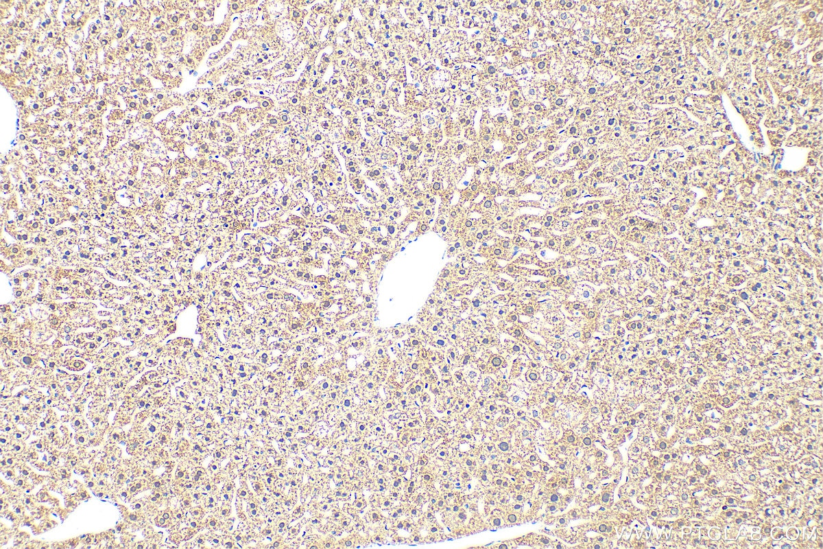 Immunohistochemistry (IHC) staining of mouse liver tissue using TASOR Polyclonal antibody (30188-1-AP)