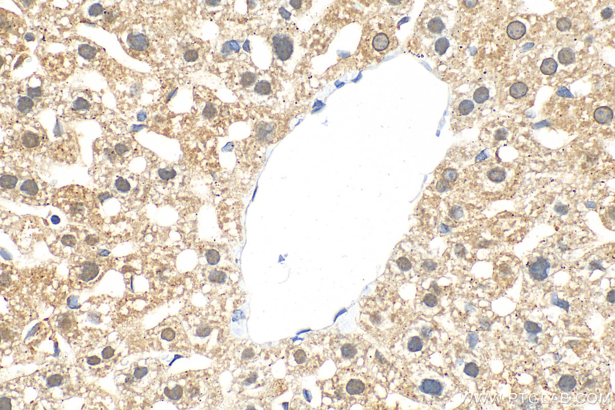 Immunohistochemistry (IHC) staining of mouse liver tissue using TASOR Polyclonal antibody (30188-1-AP)