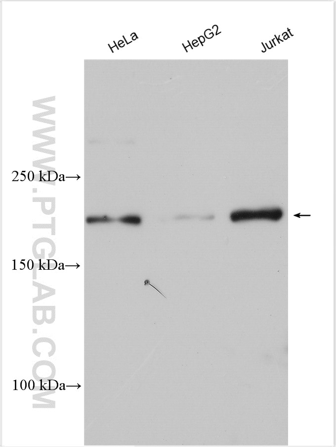 Western Blot (WB) analysis of various lysates using TASOR Polyclonal antibody (30188-1-AP)