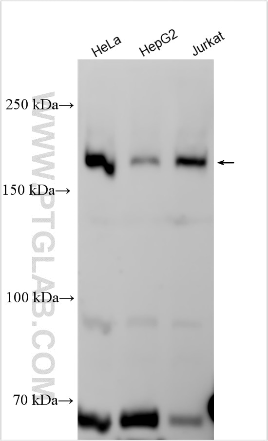 Western Blot (WB) analysis of various lysates using TASOR Polyclonal antibody (30188-1-AP)