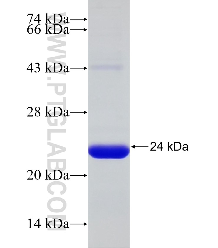 TASOR fusion protein Ag32744 SDS-PAGE