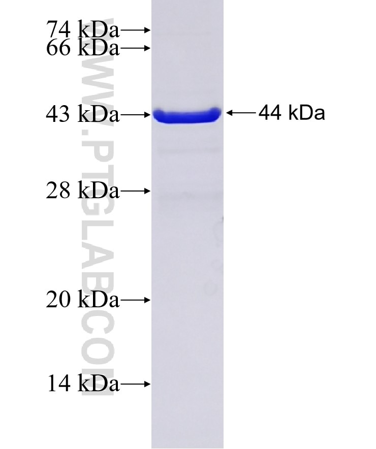 TASOR fusion protein Ag32757 SDS-PAGE