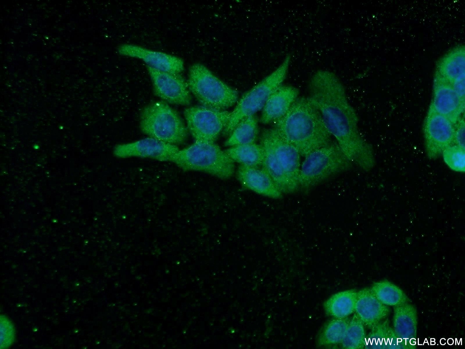 Immunofluorescence (IF) / fluorescent staining of HeLa cells using TASP1 Polyclonal antibody (16739-1-AP)