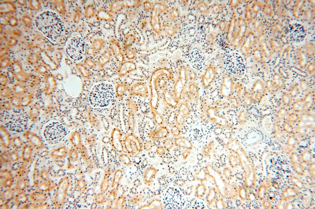Immunohistochemistry (IHC) staining of human kidney tissue using TASP1 Polyclonal antibody (16739-1-AP)