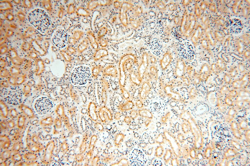 IHC staining of human kidney using 16739-1-AP