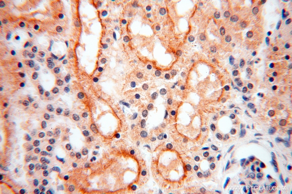 Immunohistochemistry (IHC) staining of human kidney tissue using TASP1 Polyclonal antibody (16739-1-AP)