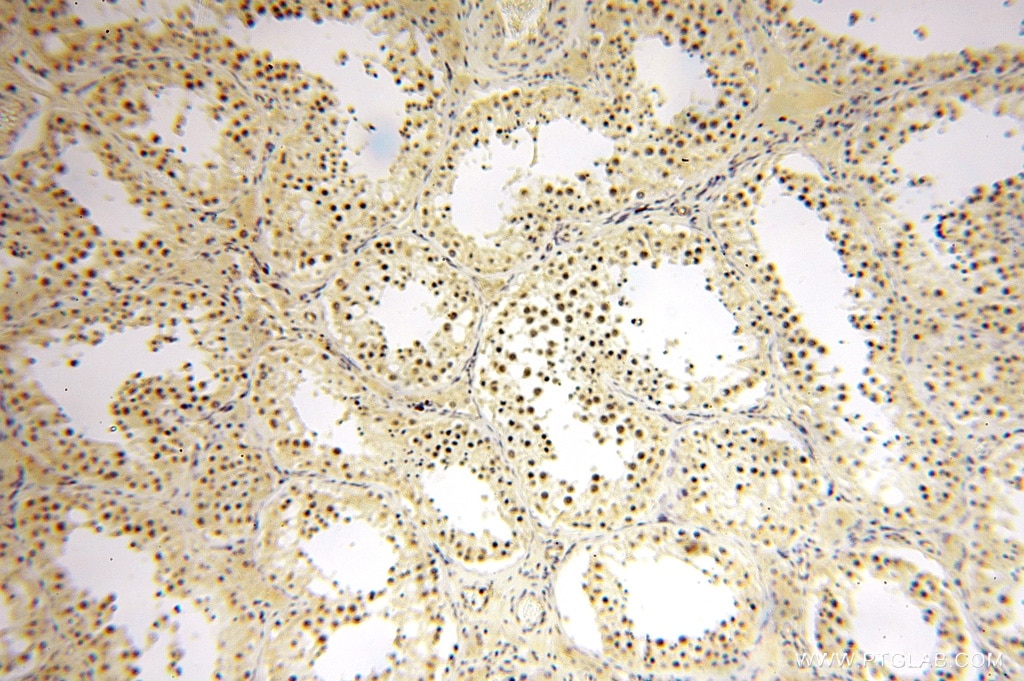 Immunohistochemistry (IHC) staining of human testis tissue using TASP1 Polyclonal antibody (16739-1-AP)