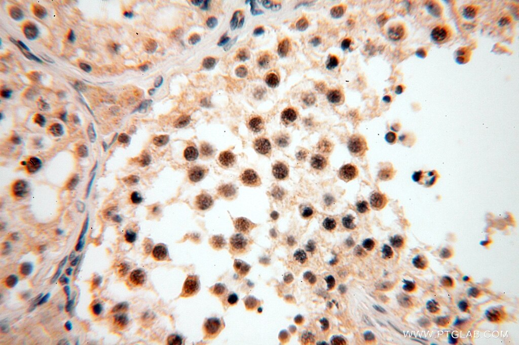 Immunohistochemistry (IHC) staining of human testis tissue using TASP1 Polyclonal antibody (16739-1-AP)