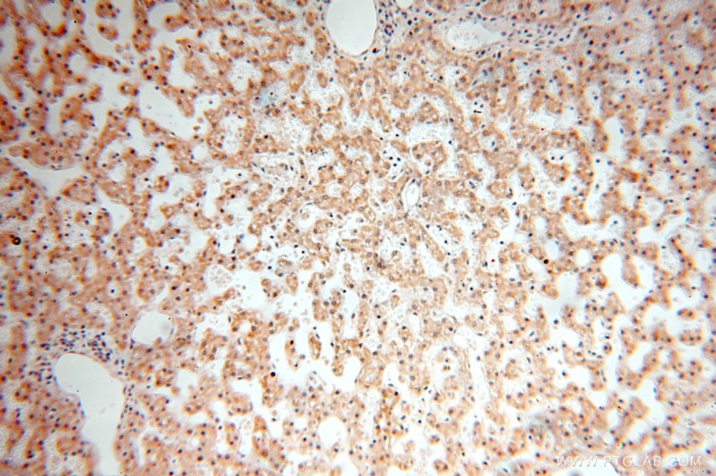 Immunohistochemistry (IHC) staining of human liver tissue using TASP1 Polyclonal antibody (16739-1-AP)