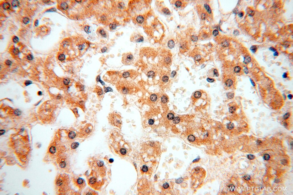 Immunohistochemistry (IHC) staining of human liver tissue using TASP1 Polyclonal antibody (16739-1-AP)