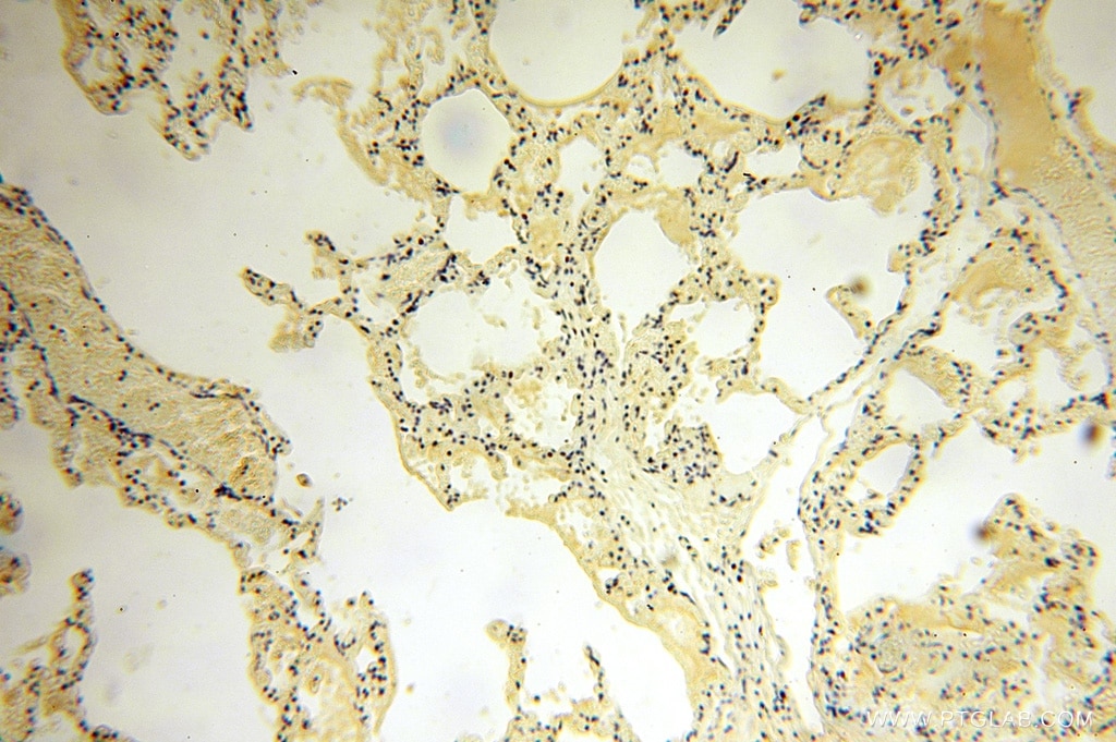 Immunohistochemistry (IHC) staining of human lung tissue using TASP1 Polyclonal antibody (16739-1-AP)