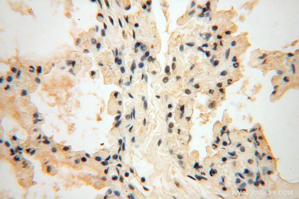 Immunohistochemistry (IHC) staining of human lung tissue using TASP1 Polyclonal antibody (16739-1-AP)