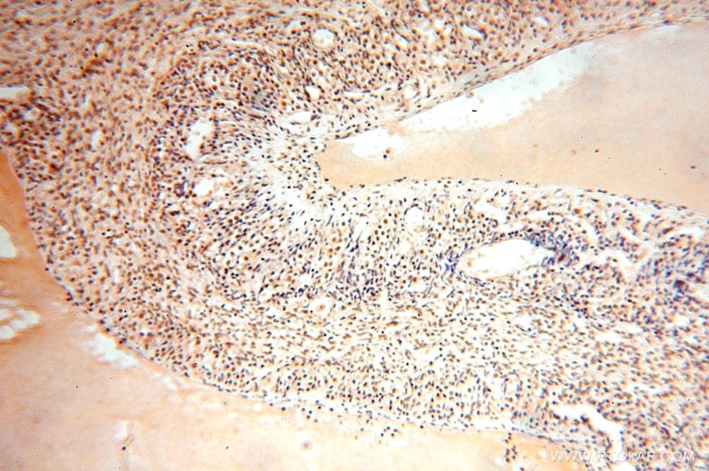Immunohistochemistry (IHC) staining of human ovary tissue using TASP1 Polyclonal antibody (16739-1-AP)