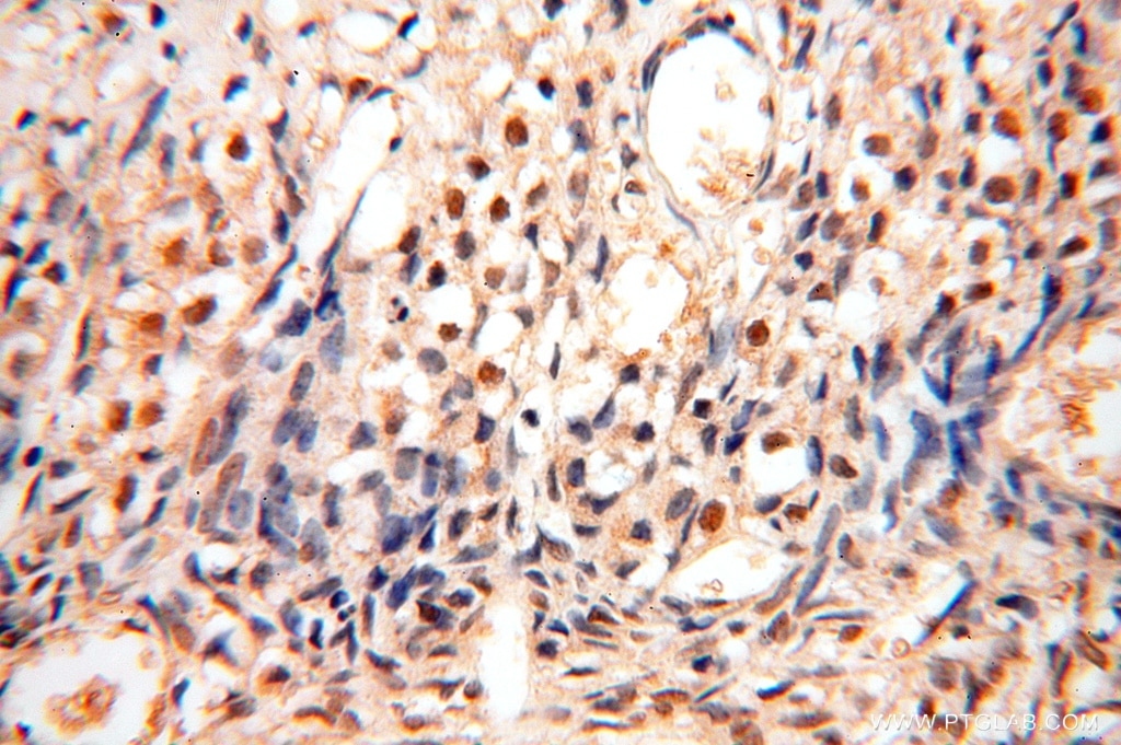 Immunohistochemistry (IHC) staining of human ovary tissue using TASP1 Polyclonal antibody (16739-1-AP)