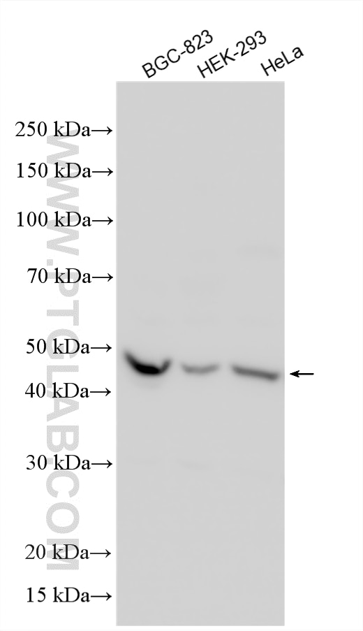 Western Blot (WB) analysis of various lysates using TASP1 Polyclonal antibody (16739-1-AP)