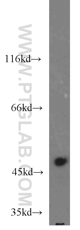 Western Blot (WB) analysis of HeLa cells using TASP1 Polyclonal antibody (16739-1-AP)