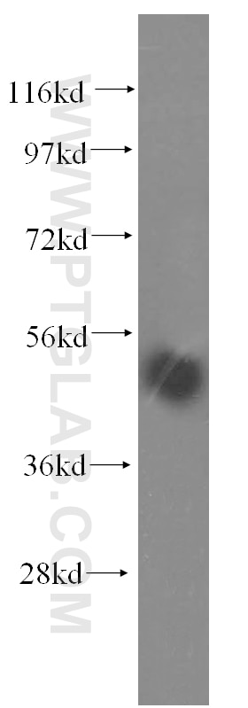 Western Blot (WB) analysis of HeLa cells using TASP1 Polyclonal antibody (16739-1-AP)