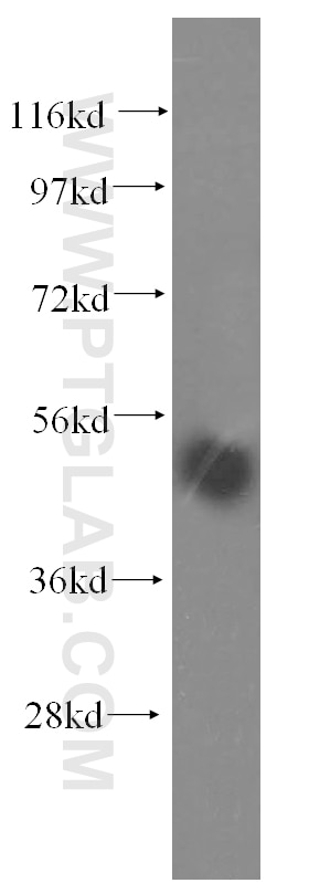 WB analysis of HeLa using 16739-1-AP